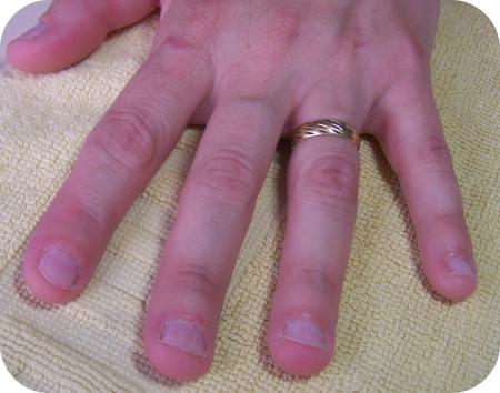 Pose Tips sur ongles rong�s