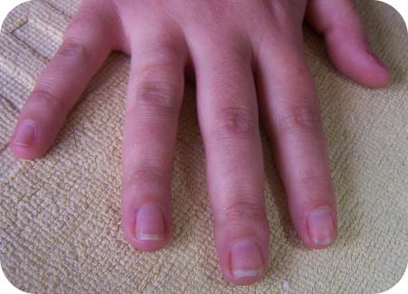 Pose french sur Aur�lie