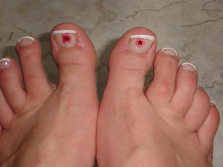 Pose french sur pieds