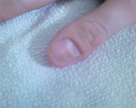 Pose gel U.V. Micka�l