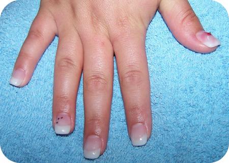 Pose french sur Dorine